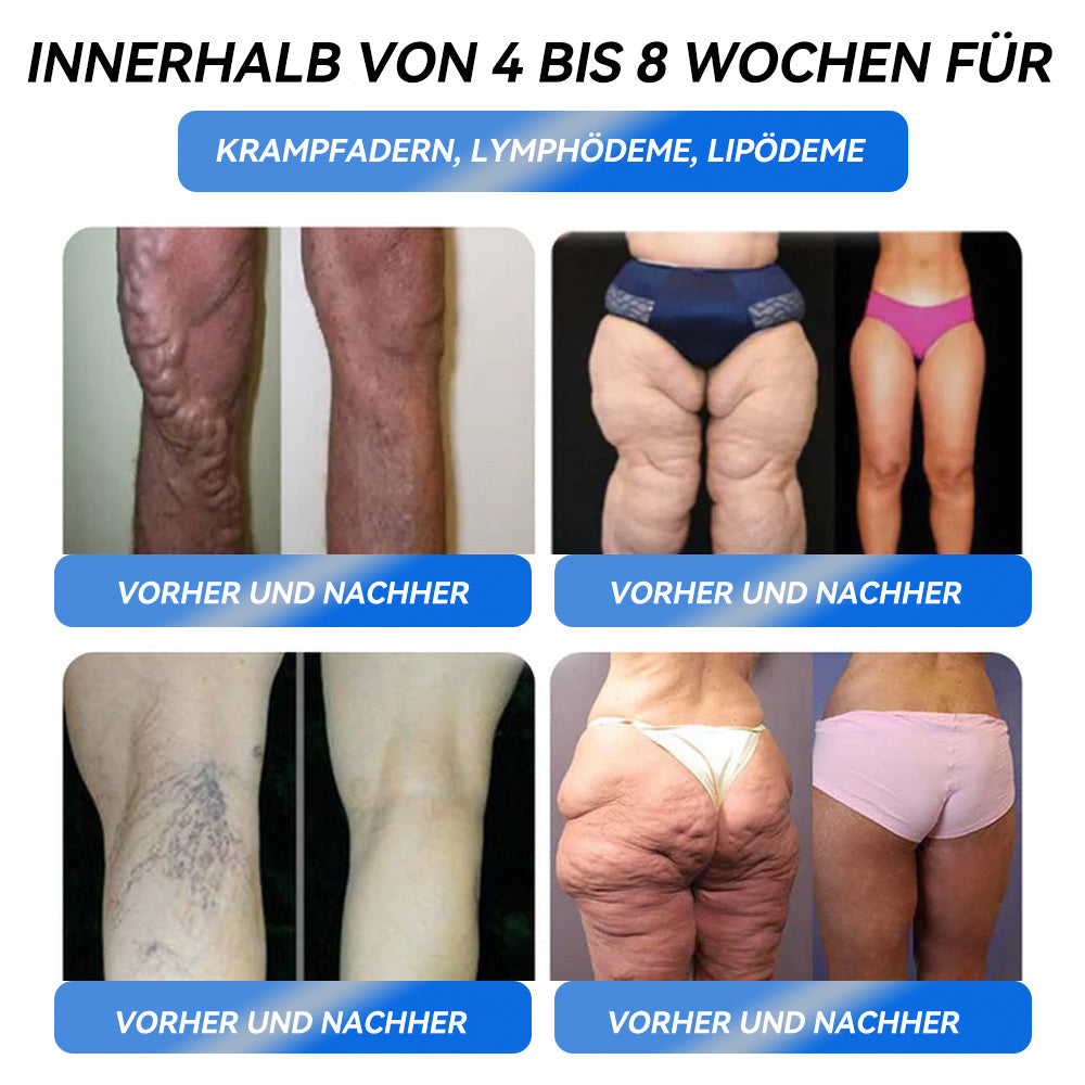 IFMAGIC® GLP-1 Pro Schlankheits-Trinklösung✅Ausgewählt vom Adipositas-Expertenteam der Charité👩⚕️Für Fettleibigkeit, Herz-Kreislauf-Erkrankungen, Diabetes, Schlafapnoe, Erhöhte Cholesterin- und Blutfettwerte, Gelenkprobleme und mehr💯