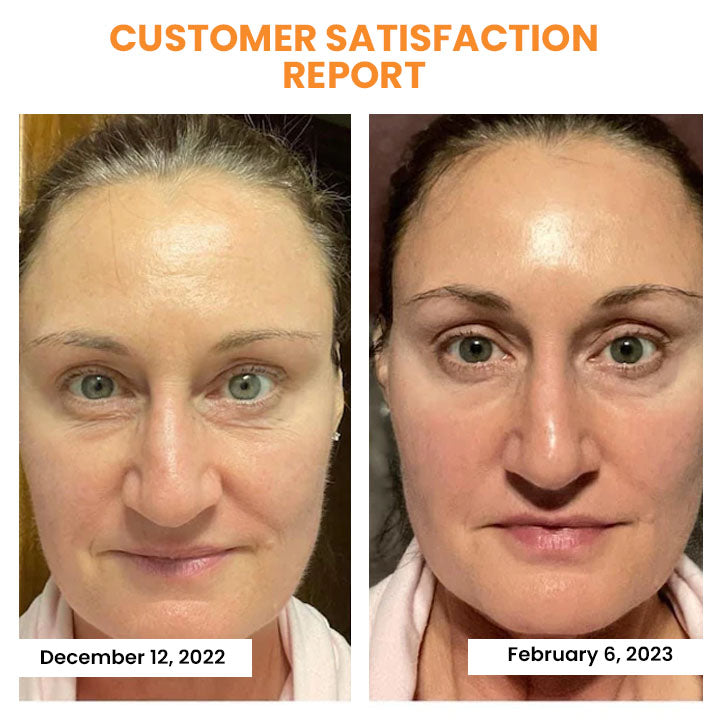 (🔥LAST DAY 70% OFF 🔥) Korean Technology Soluble Collagen Film