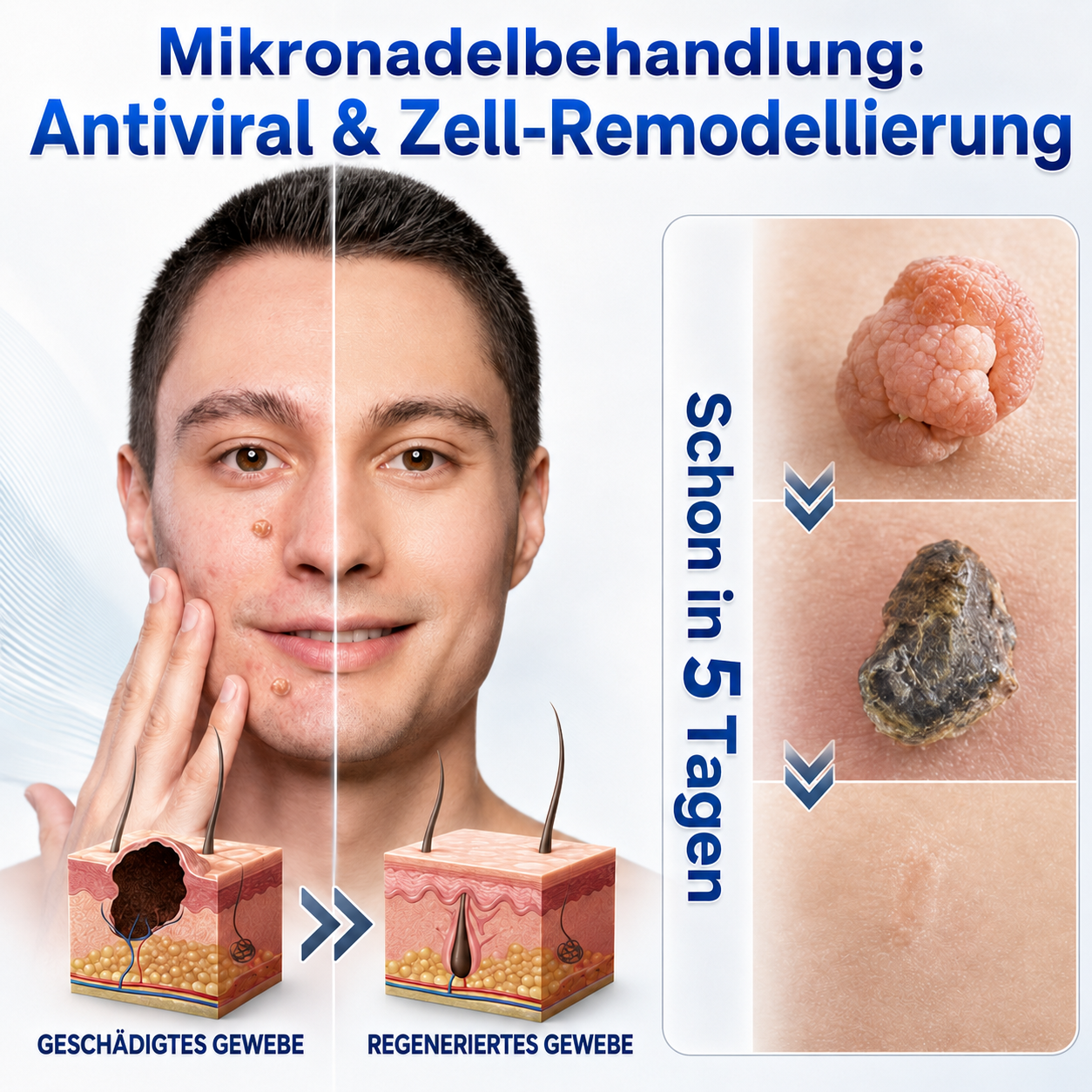 💧💧𝑶𝒇𝒇𝒊𝒛𝒊𝒆𝒍𝒍𝒆𝒓 𝑺𝒕𝒐𝒓𝒆 | 𝑵𝐞𝒌𝐢𝐬𝐬® 🌿 𝑴𝒊𝒌𝒓𝒐𝒏𝒂𝒅𝒆𝒍𝒏 𝑴𝒂𝒌𝒆𝒍𝒍𝒐𝒔𝒆 𝑯𝒂𝒖𝒕 𝑯𝒂𝒖𝒕 𝑾𝒂𝒓𝒛𝒆 𝑬𝒏𝒕𝒇𝒆𝒓𝒏𝒖𝒏𝒈 𝑷𝒇𝒍𝒂𝒔𝒕𝒆𝒓 (𝐹ü𝑟 𝐻𝑎𝑢𝑡𝑎𝑛ℎä𝑛𝑔𝑠𝑒𝑙, 𝑘𝑙𝑒𝑖𝑛𝑒 𝐻𝑎𝑢𝑡𝑤𝑢𝑐ℎ𝑒𝑟𝑢𝑛𝑔𝑒𝑛, 𝑊𝑎𝑟𝑧𝑒𝑛, 𝑀𝑢𝑡𝑡𝑒𝑟𝑚𝑎𝑙𝑒, 𝐴𝑙𝑡𝑒𝑟𝑠𝑓𝑙𝑒𝑐𝑘𝑒𝑛 𝑢𝑛𝑑 𝑃𝑖𝑔𝑚𝑒𝑛𝑡𝑠𝑡ö𝑟𝑢𝑛𝑔𝑒𝑛.)