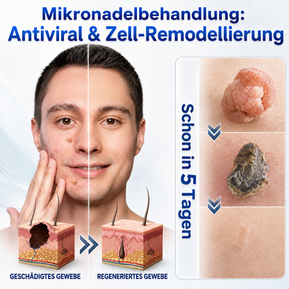 👩‍⚕️🎁𝑶𝒇𝒇𝒊𝒛𝒊𝒆𝒍𝒍𝒆𝒓 𝑺𝒕𝒐𝒓𝒆 | 𝑵𝐞𝒌𝐢𝐬𝐬® 🌿 𝑴𝒊𝒌𝒓𝒐𝒏𝒂𝒅𝒆𝒍𝒏 𝑴𝒂𝒌𝒆𝒍𝒍𝒐𝒔𝒆 𝑯𝒂𝒖𝒕 𝑯𝒂𝒖𝒕 𝑾𝒂𝒓𝒛𝒆 𝑬𝒏𝒕𝒇𝒆𝒓𝒏𝒖𝒏𝒈 𝑷𝒇𝒍𝒂𝒔𝒕𝒆𝒓 (𝐹ü𝑟 𝐻𝑎𝑢𝑡𝑎𝑛ℎä𝑛𝑔𝑠𝑒𝑙, 𝑘𝑙𝑒𝑖𝑛𝑒 𝐻𝑎𝑢𝑡𝑤𝑢𝑐ℎ𝑒𝑟𝑢𝑛𝑔𝑒𝑛, 𝑊𝑎𝑟𝑧𝑒𝑛, 𝑀𝑢𝑡𝑡𝑒𝑟𝑚𝑎𝑙𝑒, 𝐴𝑙𝑡𝑒𝑟𝑠𝑓𝑙𝑒𝑐𝑘𝑒𝑛 𝑢𝑛𝑑 𝑃𝑖𝑔𝑚𝑒𝑛𝑡𝑠𝑡ö𝑟𝑢𝑛𝑔𝑒𝑛.)